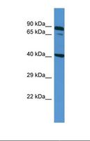 ZDHHC11B Antibody - Western blot of Human NCI-H226. ZDHHC11B antibody dilution 1.0 ug/ml.  This image was taken for the unconjugated form of this product. Other forms have not been tested.