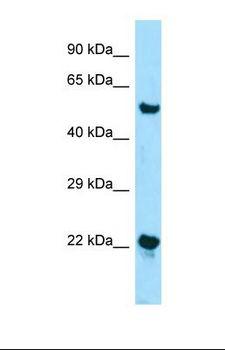 ZDHHC12 Antibody - Western blot of Human Jurkat. ZDHHC12 antibody dilution 1.0 ug/ml.  This image was taken for the unconjugated form of this product. Other forms have not been tested.