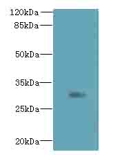 ZDHHC12 Antibody - Western blot. All lanes: ZDHHC12 antibody at 0.4 ug/ml+A40- whole cell lysate Goat polyclonal to rabbit at 1:10000 dilution. Predicted band size: 31 kDa. Observed band size: 31 kDa.