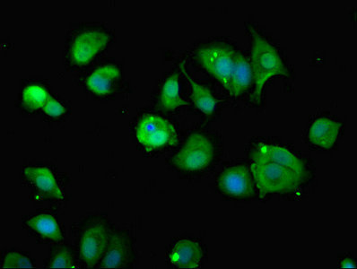 ZDHHC12 Antibody - Immunofluorescent analysis of MCF-7 cells using ZDHHC12 Antibody at dilution of 1:100 and Alexa Fluor 488-congugated AffiniPure Goat Anti-Rabbit IgG(H+L)