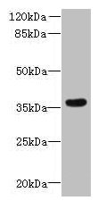 ZDHHC12 Antibody - Western blot All lanes: ZDHHC12 antibody at 0.4µg/ml + A431 whole cell lysate Secondary Goat polyclonal to rabbit IgG at 1/10000 dilution Predicted band size: 31, 25, 37 kDa Observed band size: 31 kDa