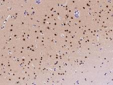 ZDHHC12 Antibody - Immunochemical staining of human ZDHHC12 in human brain with rabbit polyclonal antibody at 1:500 dilution, formalin-fixed paraffin embedded sections.