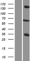 ZDHHC12 Protein - Western validation with an anti-DDK antibody * L: Control HEK293 lysate R: Over-expression lysate