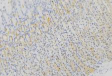 ZDHHC13 / HIP14L Antibody - 1:100 staining human gastric tissue by IHC-P. The sample was formaldehyde fixed and a heat mediated antigen retrieval step in citrate buffer was performed. The sample was then blocked and incubated with the antibody for 1.5 hours at 22°C. An HRP conjugated goat anti-rabbit antibody was used as the secondary.
