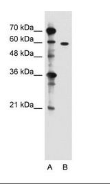 ZDHHC13 / HIP14L Antibody - A: Marker, B: Jurkat Cell Lysate.  This image was taken for the unconjugated form of this product. Other forms have not been tested.