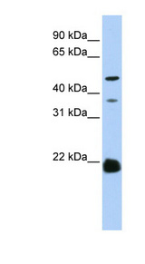 ZDHHC14 Antibody - ZDHHC14 antibody Western blot of HeLa lysate. This image was taken for the unconjugated form of this product. Other forms have not been tested.