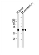 ZDHHC14 Antibody - Western blot of lysates from mouse brain and mouse cerebellum tissue lysate (from left to right) with ZDHHC14 Antibody. Antibody was diluted at 1:1000 at each lane. A goat anti-rabbit IgG H&L (HRP) at 1:5000 dilution was used as the secondary antibody. Lysates at 35 ug per lane.