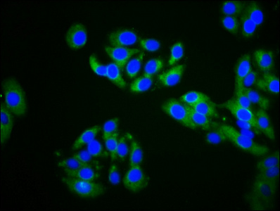 ZDHHC14 Antibody - Immunofluorescence staining of HepG2 cells diluted at 1:200, counter-stained with DAPI. The cells were fixed in 4% formaldehyde, permeabilized using 0.2% Triton X-100 and blocked in 10% normal Goat Serum. The cells were then incubated with the antibody overnight at 4°C.The Secondary antibody was Alexa Fluor 488-congugated AffiniPure Goat Anti-Rabbit IgG (H+L).
