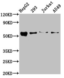 ZDHHC14 Antibody - Western Blot Positive WB detected in: HepG2 whole cell lysate, 293 whole cell lysate, Jurkat whole cell lysate, A549 whole cell lysate All Lanes: ZDHHC14 antibody at 10.5µg/ml Secondary Goat polyclonal to rabbit IgG at 1/50000 dilution Predicted band size: 54, 52 KDa Observed band size: 54 KDa