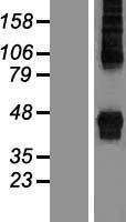 ZDHHC14 Protein - Western validation with an anti-DDK antibody * L: Control HEK293 lysate R: Over-expression lysate