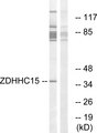 ZDHHC15 Antibody - Western blot analysis of lysates from Jurkat cells, using ZDHHC15 Antibody. The lane on the right is blocked with the synthesized peptide.