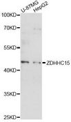 ZDHHC15 Antibody - Western blot analysis of extracts of various cell lines, using ZDHHC15 antibody at 1:1000 dilution. The secondary antibody used was an HRP Goat Anti-Rabbit IgG (H+L) at 1:10000 dilution. Lysates were loaded 25ug per lane and 3% nonfat dry milk in TBST was used for blocking. An ECL Kit was used for detection and the exposure time was 90s.