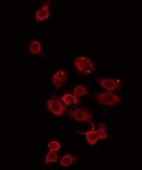 ZDHHC15 Antibody - Staining HeLa cells by IF/ICC. The samples were fixed with PFA and permeabilized in 0.1% Triton X-100, then blocked in 10% serum for 45 min at 25°C. The primary antibody was diluted at 1:200 and incubated with the sample for 1 hour at 37°C. An Alexa Fluor 594 conjugated goat anti-rabbit IgG (H+L) Ab, diluted at 1/600, was used as the secondary antibody.