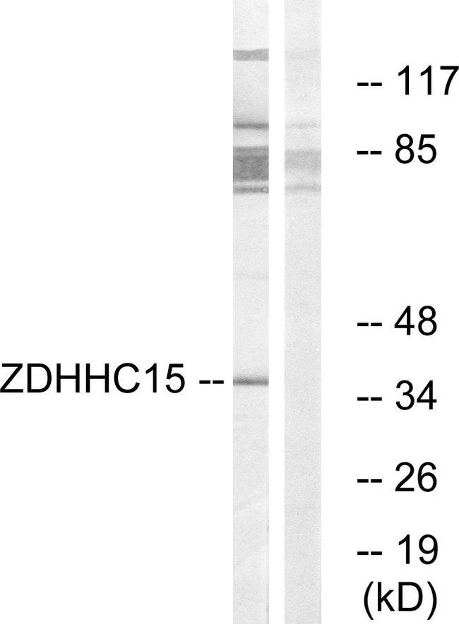 ZDHHC15 Antibody - Western blot analysis of extracts from Jurkat cells, using ZDHHC15 antibody.