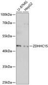 ZDHHC15 Antibody - Western blot analysis of extracts of various cell lines using ZDHHC15 Polyclonal Antibody at dilution of 1:1000.