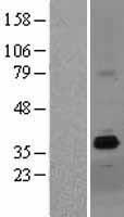 ZDHHC15 Protein - Western validation with an anti-DDK antibody * L: Control HEK293 lysate R: Over-expression lysate