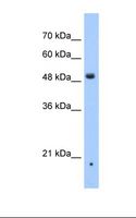 ZDHHC16 Antibody - Jurkat cell lysate. Antibody concentration: 1.0 ug/ml. Gel concentration: 12%.  This image was taken for the unconjugated form of this product. Other forms have not been tested.