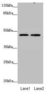 ZDHHC16 Antibody - Western blot All Lanes: ZDHHC16 antibody at 0.89 ug/ml Lane 1: MCF7 whole cell lysate Lane 2: HepG-2 whole cell lysate Secondary Goat polyclonal to Rabbit IgG at 1/10000 dilution Predicted band size: 44,42,39,35 kDa Observed band size: 44 kDa