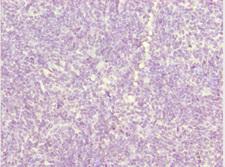 ZDHHC16 Antibody - Immunohistochemistry of paraffin-embedded human thymus tissue at dilution 1:100