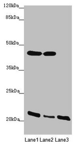ZDHHC16 Antibody - Western blot All Lanes: ZDHHC16 antibody at 1.91 ug/ml Lane 1: MCF7 whole cell lysate Lane 2: HepG-2 whole cell lysate Lane 3: A375 whole cell lysate Secondary Goat polyclonal to Rabbit IgG at 1/10000 dilution Predicted band size: 44,42,39,35 kDa Observed band size: 44,22 kDa