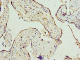 ZDHHC17 Antibody - Immunohistochemistry of paraffin-embedded human placenta tissues at dilution 1:100