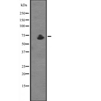 ZDHHC17 Antibody - Western blot analysis of ZDHHC17 expression in C8D30 whole cells lysate. The lane on the left is treated with the antigen-specific peptide.