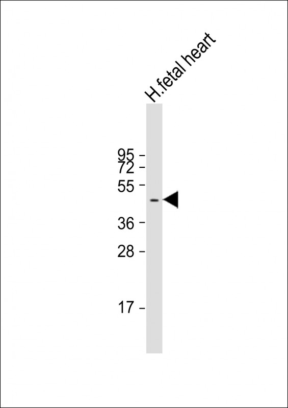 ZDHHC18 Antibody - Anti-ZDHHC18 Antibody (C-Term) at 1:1000 dilution + human fetal heart lysate Lysates/proteins at 20 µg per lane. Secondary Goat Anti-Rabbit IgG, (H+L), Peroxidase conjugated at 1/10000 dilution. Predicted band size: 42 kDa Blocking/Dilution buffer: 5% NFDM/TBST.
