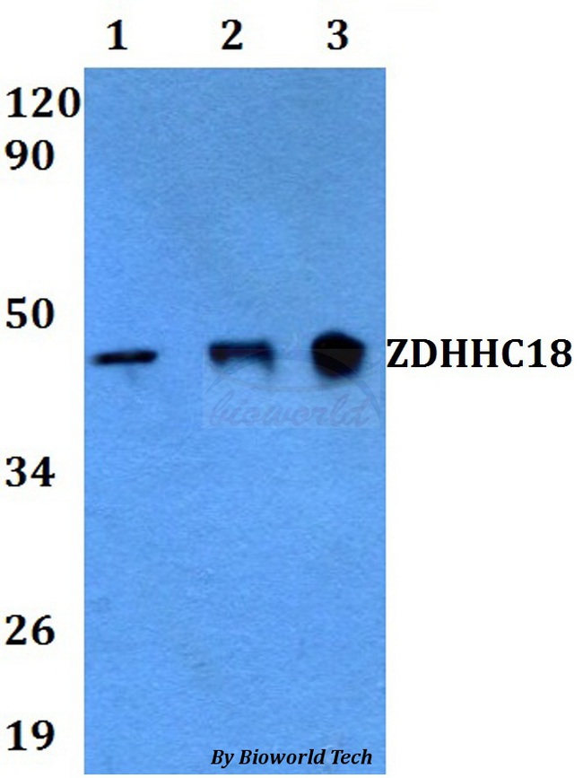 ZDHHC18 Antibody - Western blot of ZDHHC18 antibody at 1:500 dilution. Lane 1: A549 whole cell lysate. Lane 2: MCF-7 whole cell lysate.