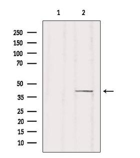 ZDHHC18 Antibody - Western blot analysis of extracts of HuvEc cells using ZDHHC18 antibody. Lane 1 was treated with the blocking peptide.