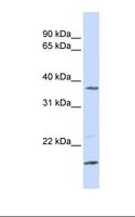 ZDHHC19 Antibody - MCF7 cell lysate. Antibody concentration: 1.0 ug/ml. Gel concentration: 12%.  This image was taken for the unconjugated form of this product. Other forms have not been tested.