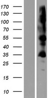 ZDHHC19 Protein - Western validation with an anti-DDK antibody * L: Control HEK293 lysate R: Over-expression lysate