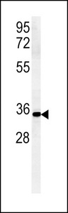 ZDHHC2 Antibody - ZDHC2 Antibody western blot of mouse Neuro-2a cell line lysates (15 ug/lane). The ZDHC2 antibody detected the ZDHC2 protein (arrow).