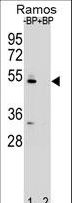 ZDHHC2 Antibody - Western blot of ZDHC2 Antibody antibody pre-incubated without(lane 1) and with(lane 2) blocking peptide in Ramos cell line lysate. ZDHC2 Antibody (arrow) was detected using the purified antibody.