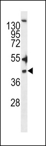 ZDHHC20 Antibody - ZDHHC20 Antibody western blot of NCI-H460 cell line lysates (35 ug/lane). The ZDHHC20 antibody detected the ZDHHC20 protein (arrow).