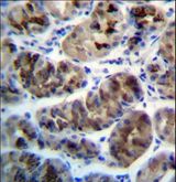 ZDHHC20 Antibody - ZDHHC20 Antibody immunohistochemistry of formalin-fixed and paraffin-embedded human stomach tissue followed by peroxidase-conjugated secondary antibody and DAB staining.