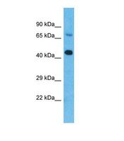 ZDHHC20 Antibody - Western blot of Human HepG2. ZDHHC20 antibody dilution 1.0 ug/ml.  This image was taken for the unconjugated form of this product. Other forms have not been tested.