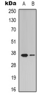 ZDHHC20 Antibody - Western blot analysis of ZDHHC20 expression in MCF7 (A); HepG2 (B) whole cell lysates.