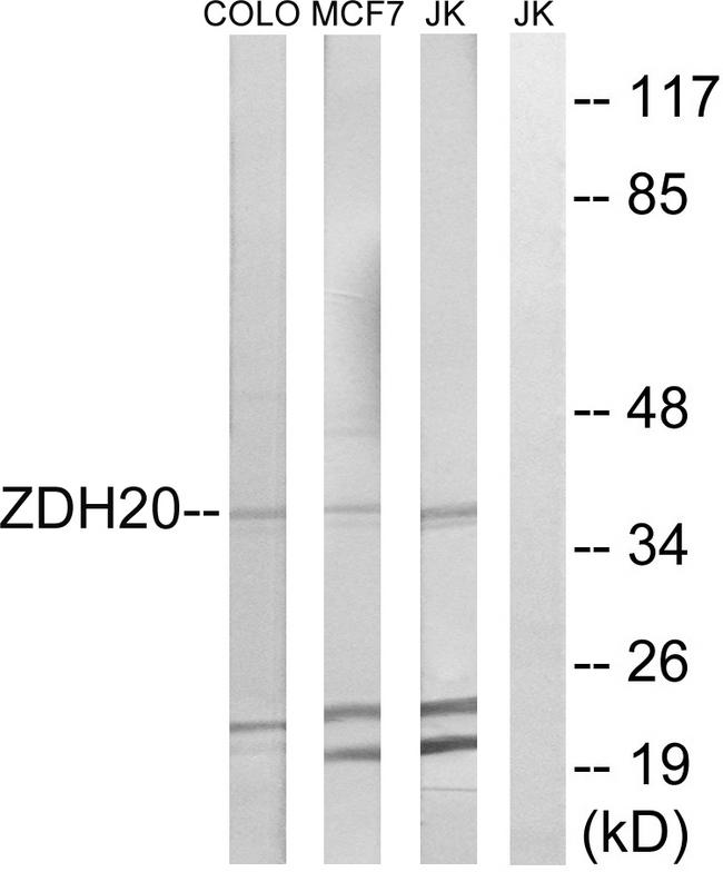 ZDHHC20 Antibody - Western blot analysis of extracts from COLO cells, MCF-7 cells and Jurkat cells, using ZDHHC20 antibody.