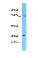 ZDHHC20 Antibody - Western blot of Human THP-1. ZDHHC20 antibody dilution 1.0 ug/ml.  This image was taken for the unconjugated form of this product. Other forms have not been tested.