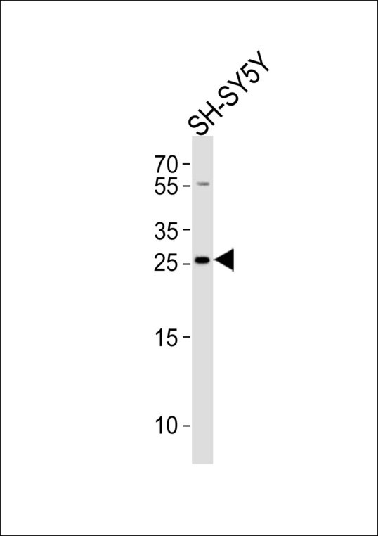 ZDHHC21 Antibody - Western blot of lysate from SH-SY5Y cell line, using ZDHHC21 Antibody. Antibody was diluted at 1:1000. A goat anti-rabbit IgG H&L (HRP) at 1:10000 dilution was used as the secondary antibody. Lysate at 20ug.