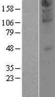 ZDHHC21 Protein - Western validation with an anti-DDK antibody * L: Control HEK293 lysate R: Over-expression lysate