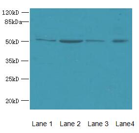 ZDHHC23 Antibody - Western blot. All lanes: ZDHHC23 antibody at 8 ug/ml. Lane 1: 293T whole cell lysate. Lane 2: Mouse brain tissue. Lane 3: A549 whole cell lysate. Lane 4: Human placenta tissue. Secondary antibody: Goat polyclonal to Rabbit IgG at 1:10000 dilution. Predicted band size: 46 kDa. Observed band size: 46 kDa.
