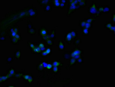 ZDHHC23 Antibody - Immunofluorescent analysis of 293T cells using ZDHHC23 Antibody at dilution of 1:100 and Alexa Fluor 488-congugated AffiniPure Goat Anti-Rabbit IgG(H+L)