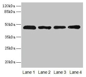 ZDHHC23 Antibody - Western blot All lanes: ZDHHC23 antibody at 8µg/ml Lane 1: 293T whole cell lysate Lane 2: Mouse brain tissue Lane 3: A549 whole cell lysate Lane 4: Human placenta tissue Secondary Goat polyclonal to rabbit IgG at 1/10000 dilution Predicted band size: 46 kDa Observed band size: 46 kDa