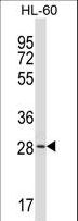 ZDHHC24 Antibody - ZDHHC24 Antibody western blot of HL-60 cell line lysates (35 ug/lane). The ZDHHC24 antibody detected the ZDHHC24 protein (arrow).