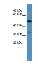 ZDHHC3 Antibody - ZDHHC3 antibody Western blot of ACHN lysate.  This image was taken for the unconjugated form of this product. Other forms have not been tested.