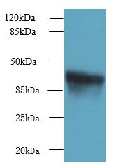 ZDHHC4 Antibody - Western blot. All lanes: ZDHHC4 antibody at 1.5 ug/ml+ Mouse liver tissue Goat polyclonal to rabbit at 1:10000 dilution. Predicted band size: 40 kDa. Observed band size: 40 kDa.