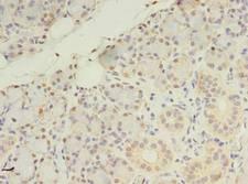 ZDHHC4 Antibody - Immunohistochemistry of paraffin-embedded human pancreatic tissue using antibody at dilution of 1:100.