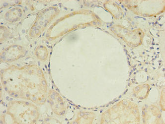 ZDHHC4 Antibody - Immunohistochemistry of paraffin-embedded human kidney tissue using ZDHHC4 Antibody at dilution of 1:100