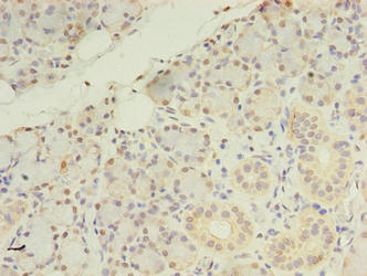 ZDHHC4 Antibody - Immunohistochemistry of paraffin-embedded human pancreatic tissue using ZDHHC4 Antibody at dilution of 1:100